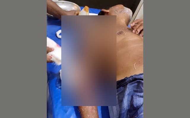 প্রাচীর নির্মাণকে কেন্দ্র করে পাঁচবিবিতে হামলায়