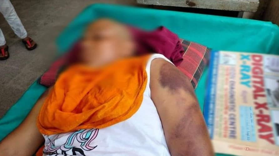 বাসায় এনে গৃহকর্মীকে ধর্ষণ করলেন স্বামী, স্ত্রী কাটলেন চুল!