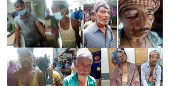 বালু তোলা নিয়ে সংঘর্ষে গুলিবিদ্ধ ৭