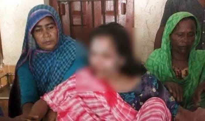 কবিরাজের চিকিৎসায় ঝলসে গেল নারীর মুখ !