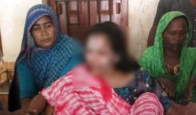 কবিরাজের চিকিৎসায় ঝলসে গেল নারীর মুখ !