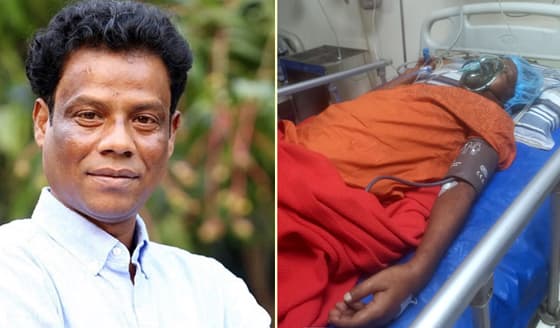 কণ্ঠশিল্পী আকবরের ডান পা কেটে ফেলা হয়েছে