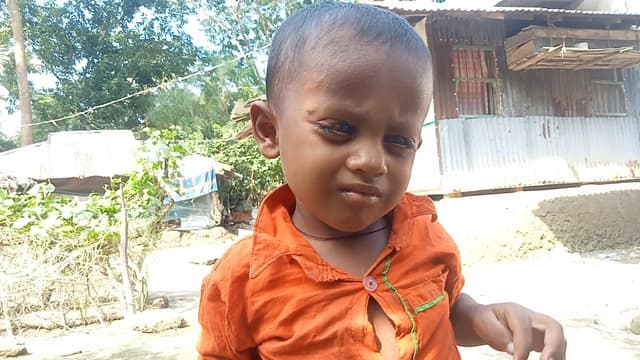 কলাপাড়ায় অর্থের অভাবে অন্ধ হতে চলেছে শিশু তাওহিদ, সাহায্যের আবেদন
