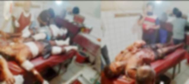 বেনাপোলে বোমা তৈরি কালে বিষ্ফোরণে ৩ যুবক আহত