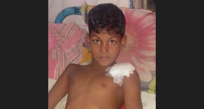 খেলাকে কেন্দ্র করে শিশুকে কুপিয়ে জখম