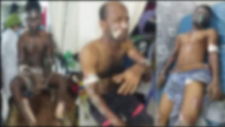 মোংলায় গ্যাস কারখানায় সিলিন্ডার বিস্ফোরণ, দগ্ধ ৬