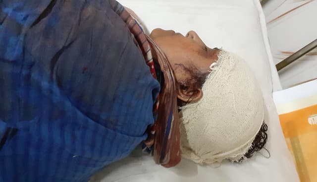 ঝালকাঠিতে ননদকে কোপালো ছোট ভাইয়ের বউ