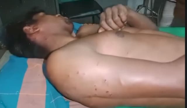 ভূরুঙ্গামারী সীমান্তে বিএসএফের গুলিতে এক বাংলাদেশী যুবক আহত