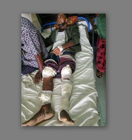 শরীয়তপুরে আওয়ামীলীগের দুই গ্রুপের সংঘর্ষ আহত ৩৭