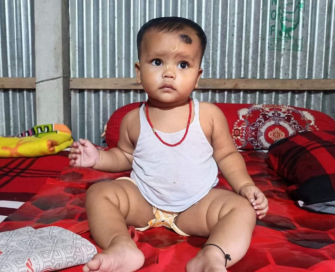 ভূরুঙ্গামারীতে টাকার অভাবে অবুঝ শিশু রিয়াংশির চিকিৎসা করাতে পাচ্ছেনা পরিবার