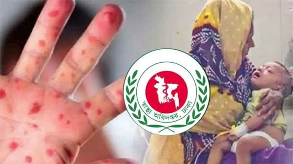 দেশে হামে ভয়াবহ শিশু মৃত্যু ইতিহাসে নজিরবিহীন সংকট