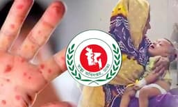 দেশে ২৪ ঘণ্টায় হাম উপসর্গে ৮ শিশুর মৃত্যু