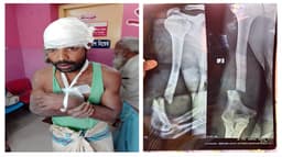 নোয়াখালীতে কৃষকের হাত ভেঙে কুপিয়ে জখম