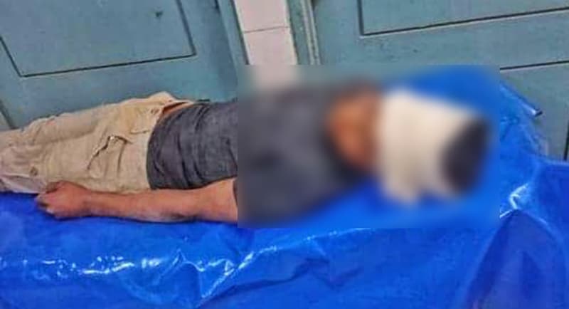 মেহেরপুরে সড়ক দুর্ঘটনায় যুবক আহত