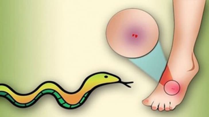 হিজলায় সাপের কামড়ে আহত ইউএনও এর কন্যা