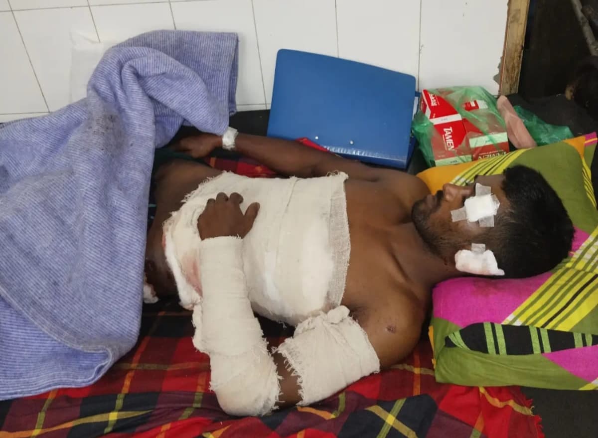 কালকিনিতে বোমা হামলায় মালয়েশিয়া প্রবাসী গুরুতর আহত