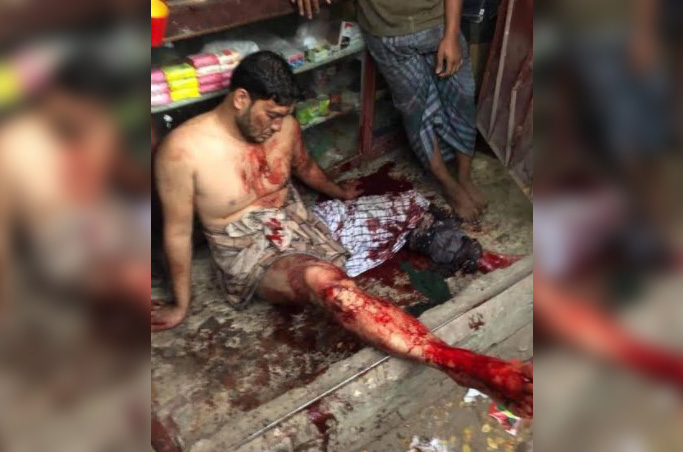 টেকনাফে ছুরিকাঘাত ও গুলিতে এক ব্যক্তি গুরুতর আহত