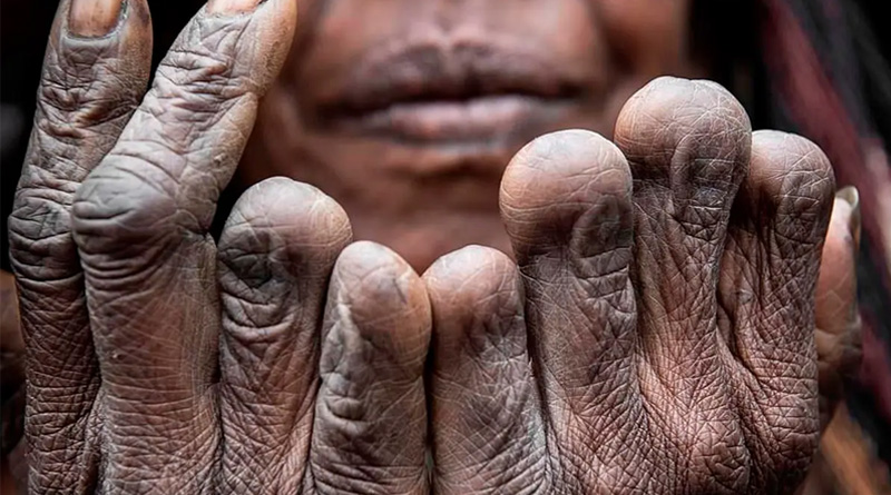 পরিবারের কেউ মারা গেলেই কাটা হয় মহিলাদের আঙুল!