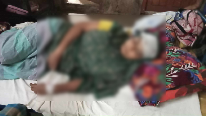 স্বামীর বিরুদ্ধে যৌতুক মামলা করায় স্ত্রীকে কুপিয়ে জখম